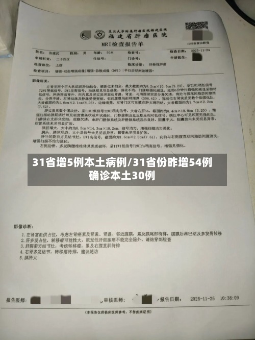 31省增5例本土病例/31省份昨增54例确诊本土30例-第3张图片
