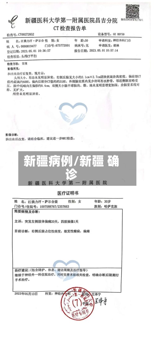新疆病例/新疆 确诊-第2张图片