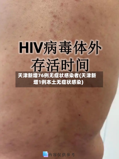天津新增76例无症状感染者(天津新增1例本土无症状感染)-第2张图片